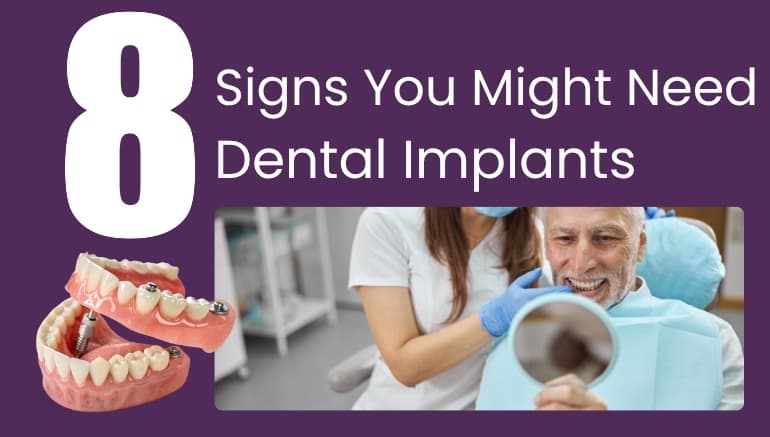 signs-you-might-need-dental-implants