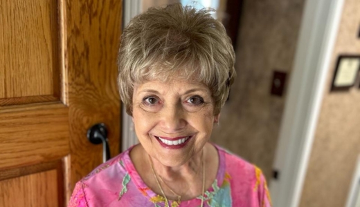 Smile Makeover - Before