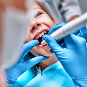 Dental Fillings & Crowns