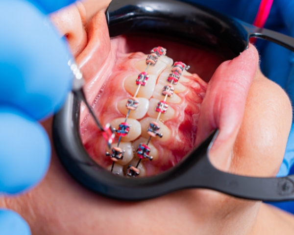 Orthodontics