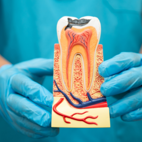 Benefits of root canal treatment