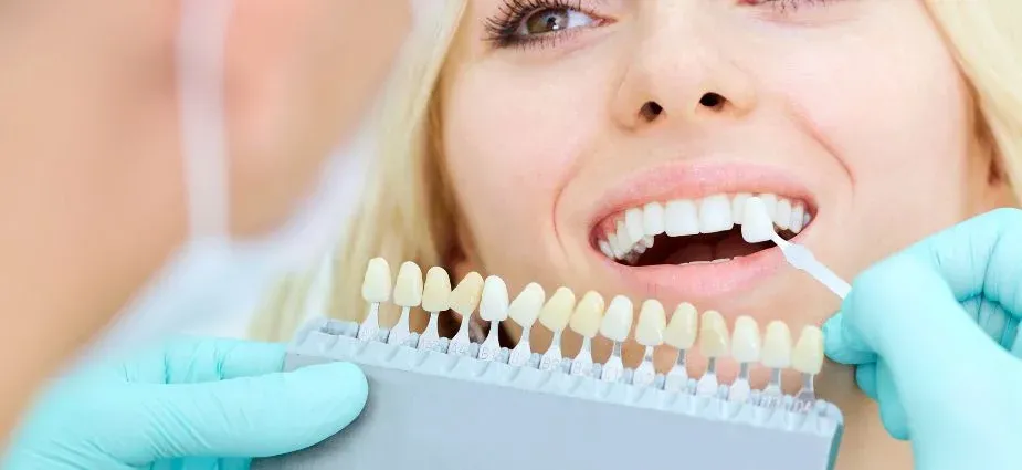 Teeth whitening in Texas