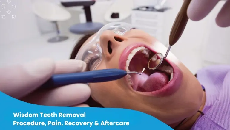 Wisdom Teeth Removal in Texas
