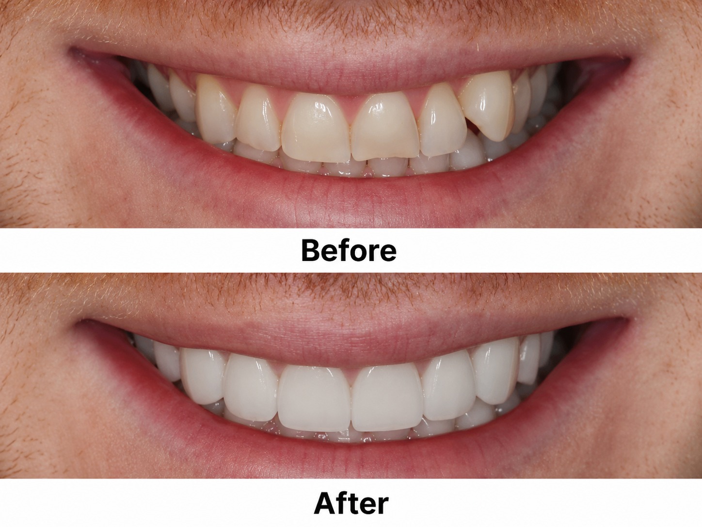 Cosmetic Treatment Near You