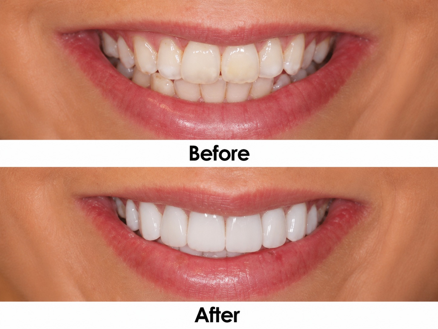 Cosmetic Treatment