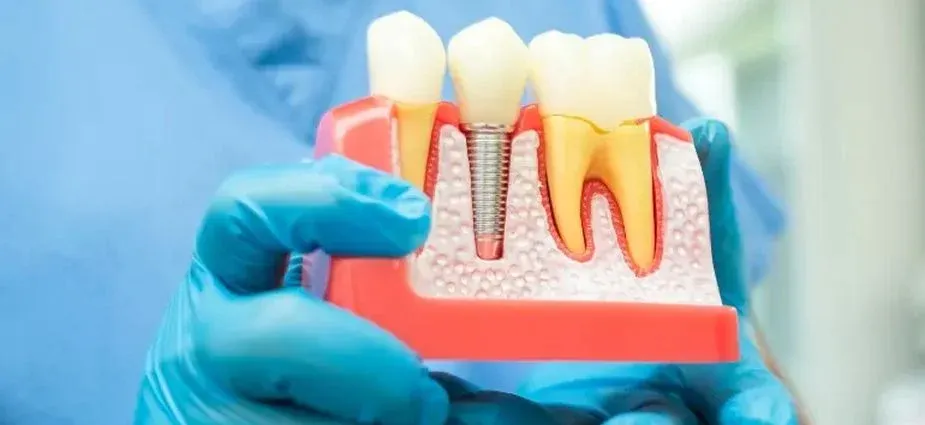 Dr. Hassan Asghar providing dental implant treatment at Frontier Dentistry in Springtown, Texas