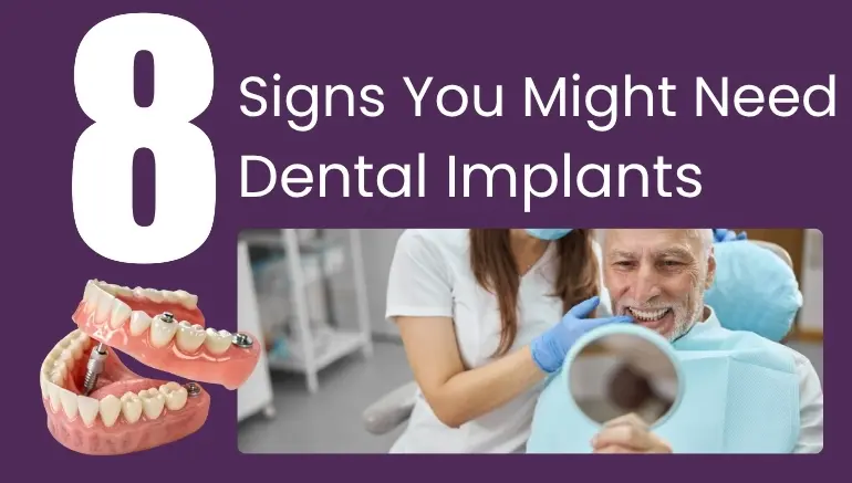 8 Signs You Might Need Dental Implants