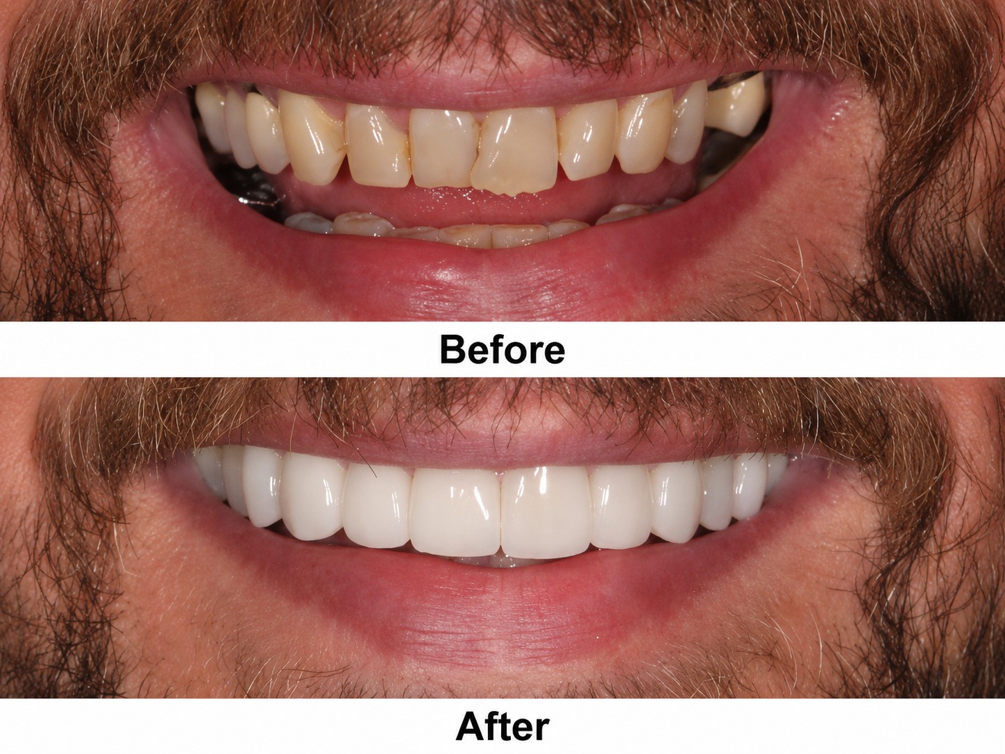 Happy Patient