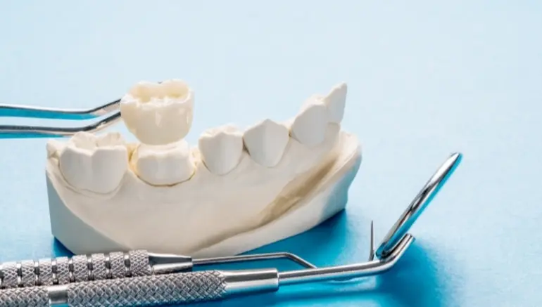 dental crown