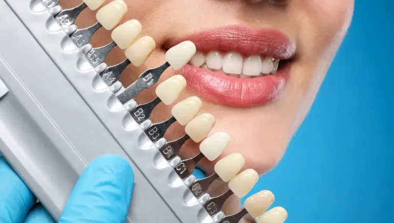 Cosmetic Dentist in Texas for Your Dream Smile
