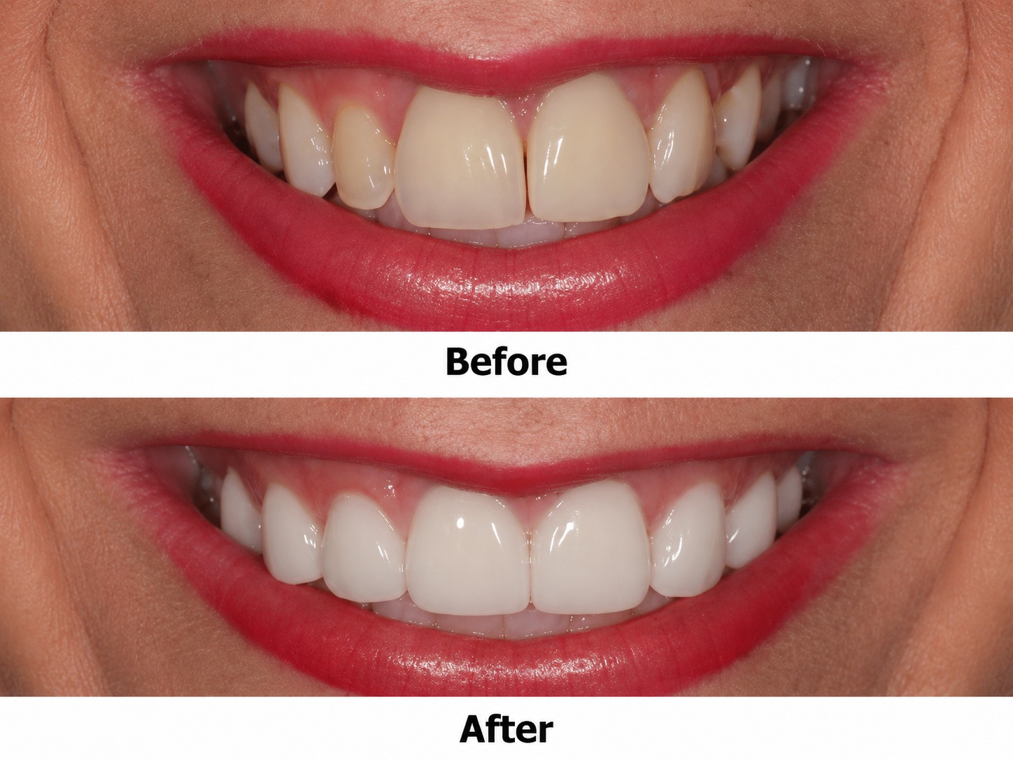 Springtown Happy Patient