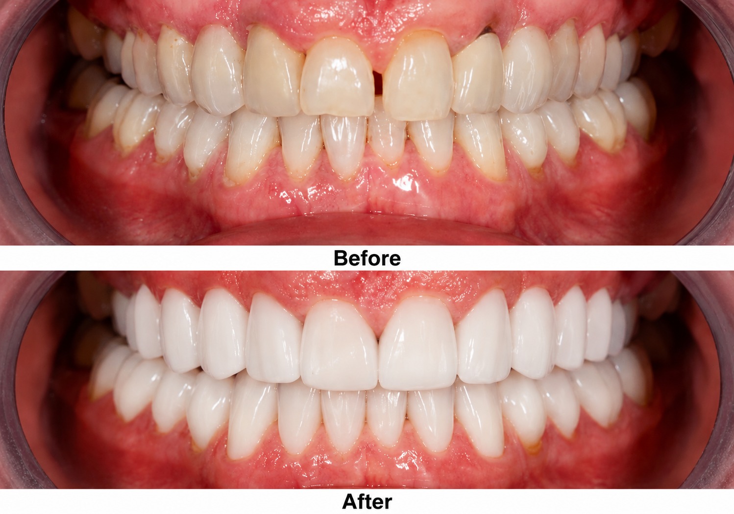 Patient Smile Transformation