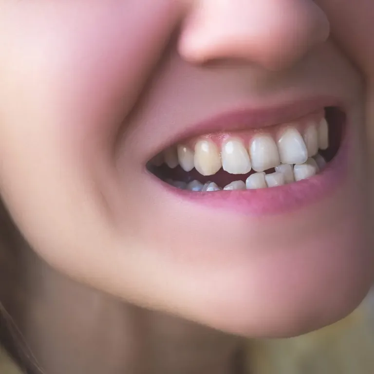 Crooked teeth treatment in Texas