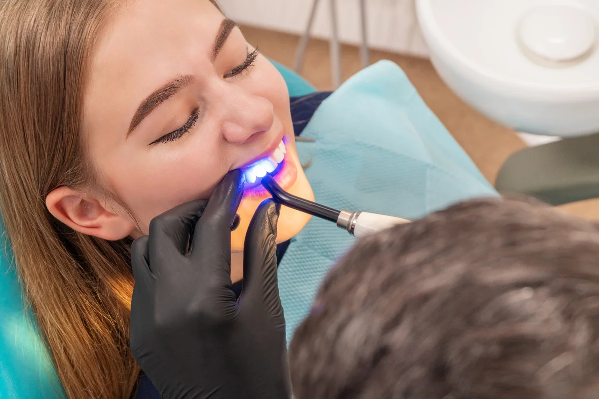 Dental Bonding