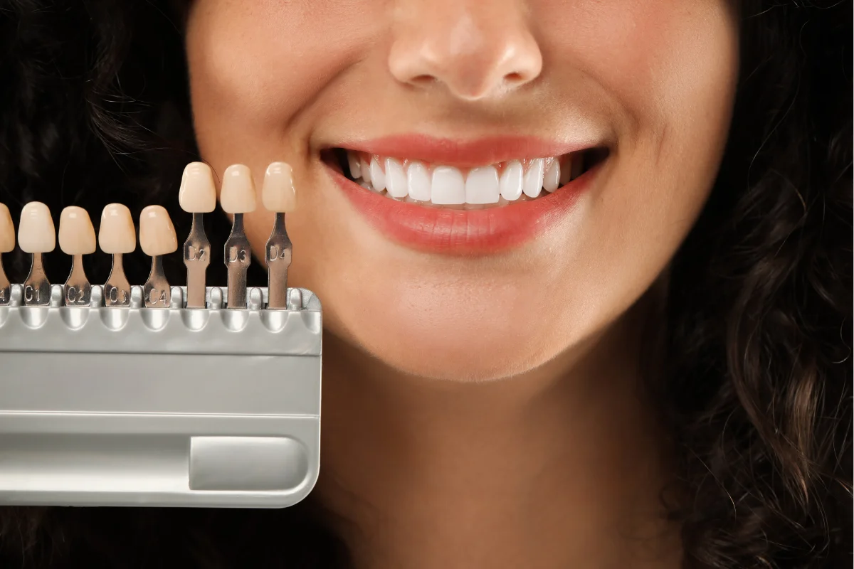 Crowns Veneers and Bridges