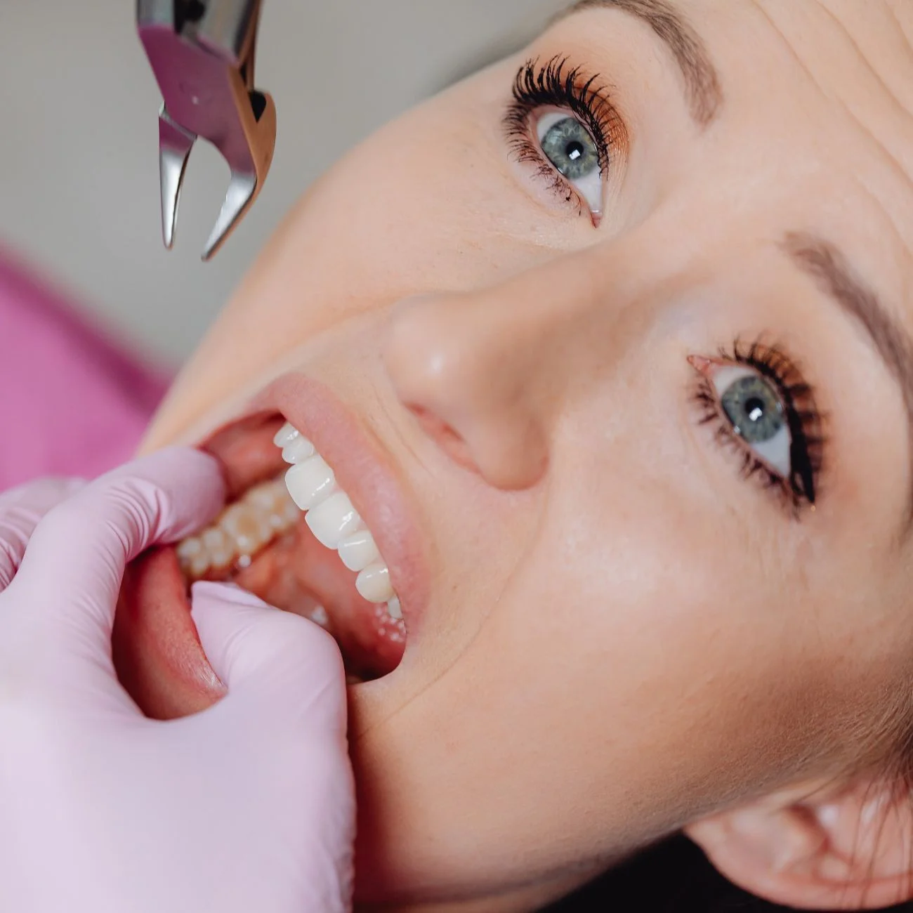 During Your Tooth Extraction
