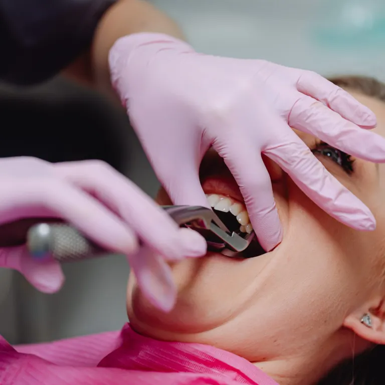 Tooth extractions in Springtown, Texas