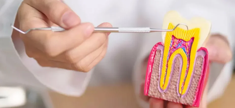 Root Canal Treatment Root Canal Treatment